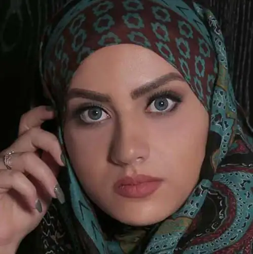 خرید لنز رنگی آبی عسلی آرین آکوا بلو تن3