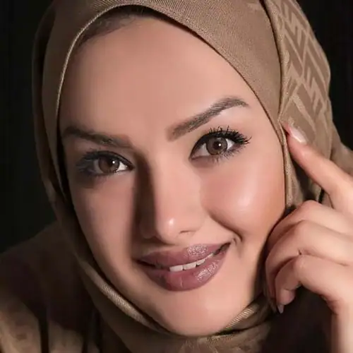 خرید لنز رنگی طوسی عسلی آرین براون تن3