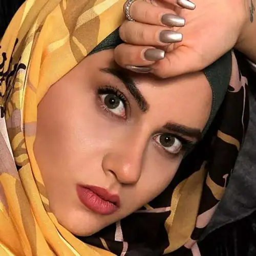 خرید لنز رنگی سبز عسلی آرین گرین تن3