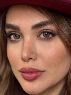 لنز رنگی عسلی رز آلیس براون