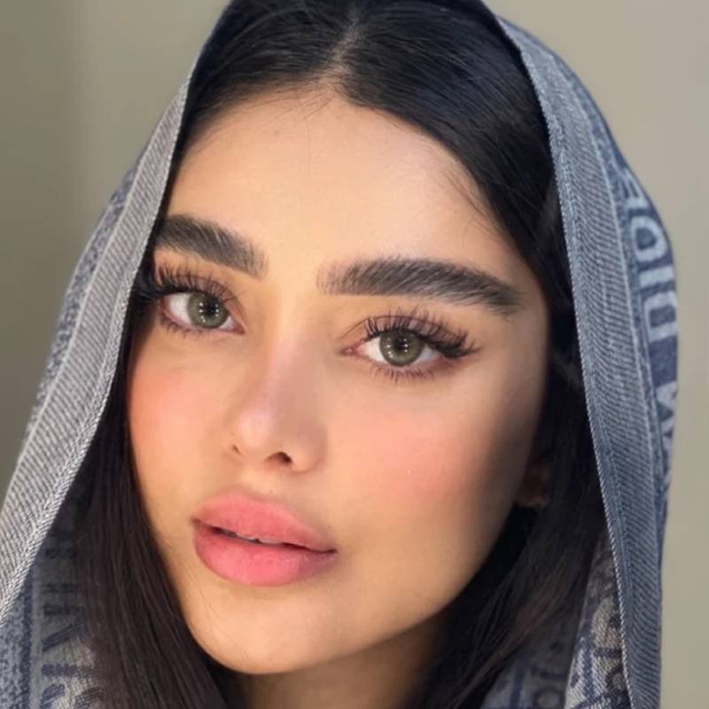 لنز رنگی سبز رز اُرکید گرین - Image 4