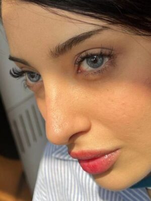 لنز طوسی آبی هاوایی بلو سلنا