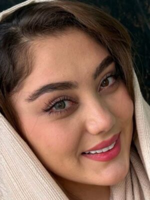 لنز رنگی سبز تیره کینگ گرین آماندا - Image 2