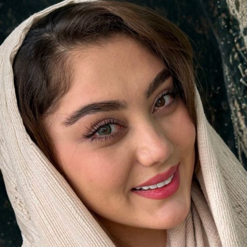 لنز رنگی سبز تیره کینگ گرین آماندا - Image 2