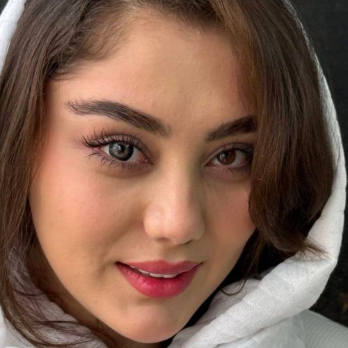 لنز رنگی مشکی عروسکی مرکز طوسی آلموند بلک آماندا - Image 2