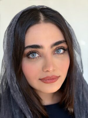 لنز رنگی سالانه لوتوس یونیک (UNIQUE LOTUS) - Image 2