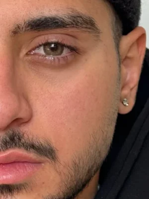 لنز رنگی قهوه ای عسلی دور دار ارکید براون رز