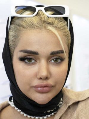 لنز رنگی سلنا سبز عسلی با رگه های کهکشانی رینگگرین ماهانه