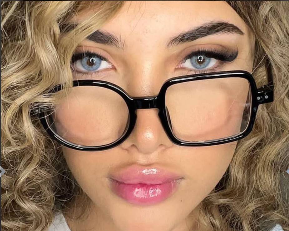 لنز لوتوس