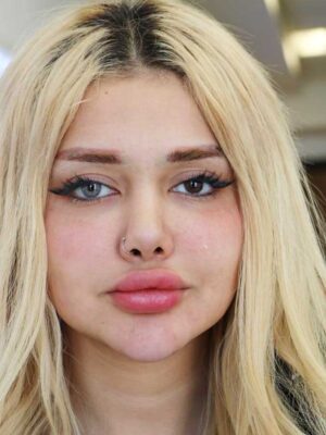 لنز رنگی سلنا طوسی خاکستری دوردار هاوایی گری ماهانه