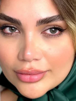 لنز یونیک ویستریال سبز لجنی دور دار
