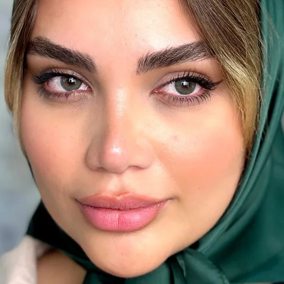 لنز یونیک ویستریال سبز لجنی دور دار