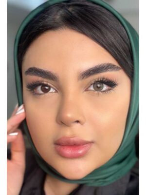 لنز رنگی یونیک سبز تیره دور دار ویستریا