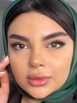لنز رنگی یونیک سبز تیره دور دار ویستریا