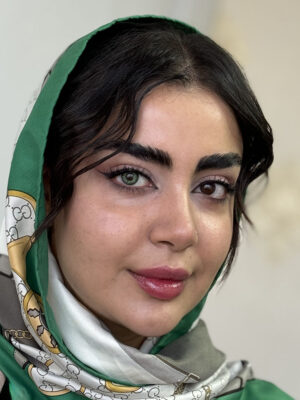 لنز سبز پسته ای آماندا آلموند گرین روی چشم قهوه ای تیره