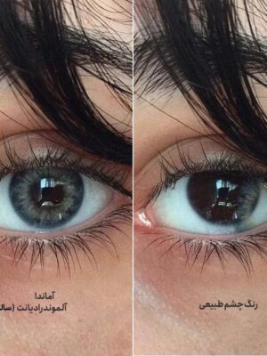 لنز طوسی سبز آلموند رادیانت آماندا روی چشم قهوه ای
