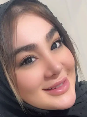 لنز آماندا پیچ بلک مشکی - Image 2