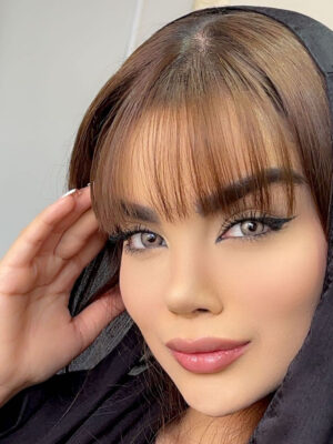 لنز چشم رنگی عسلی بژ دور مشکی آتلانتیس بژ آماندا