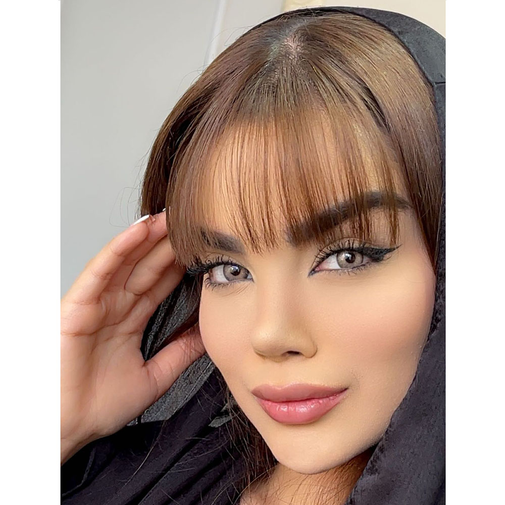 لنز چشم رنگی عسلی بژ دور مشکی آتلانتیس بژ آماندا