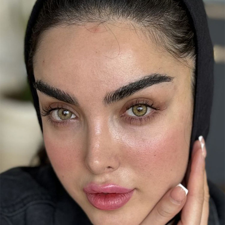 لنز عسلی دور مشکی کارامل آماندا