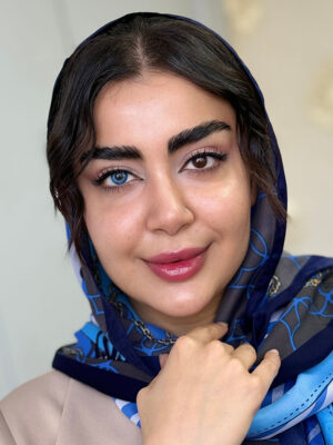 لنز آبی تیله ای نیوی بلو آماندا