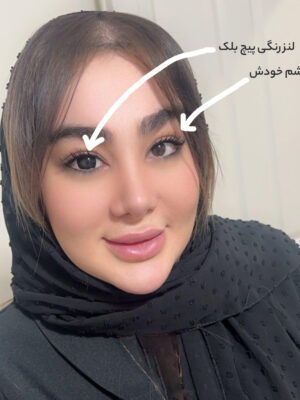 لنز مشکی عروسکی پیچ بلک آماندا