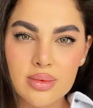 لنز سلنا یوتا عسلی دوردار - Image 3