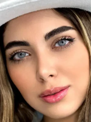 لنز یونیک کارنلین طوسی آبی تیلهای - Image 8
