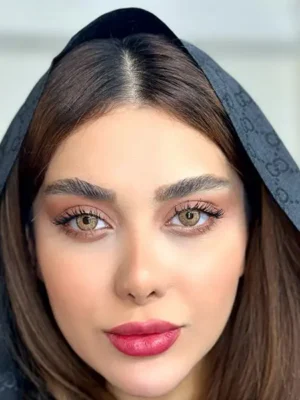لنز یونیک فلامینگو عسلی دور دار - Image 5