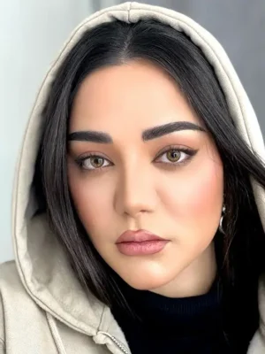 لنز یونیک لوندر عسلی دوردار - Image 3