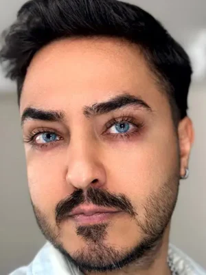 لنز یونیک لوتوس آبی بدون دور - Image 5
