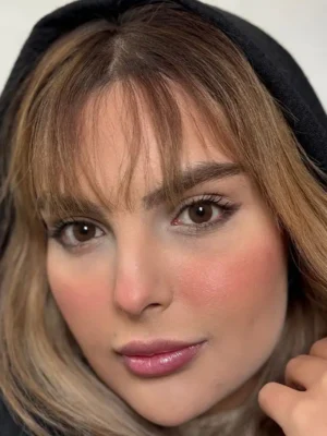 لنز یونیک نچرال هیزل قهوه ای دور دار - Image 3