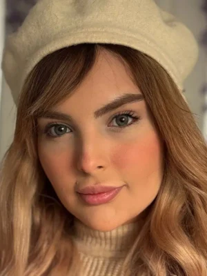 لنز یونیک نیاگارا طوسی تیره دور دار - Image 7