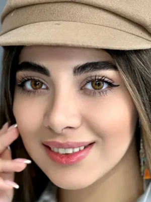 لنز یونیک رز قهوه ای عسلی - Image 2