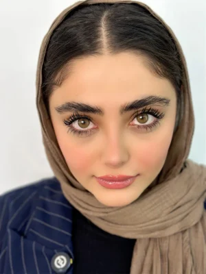لنز رنگی سبز عسلی دوردار رادین گلد آیس کالر ( ICE COLOR RADIN GOLD) - Image 2