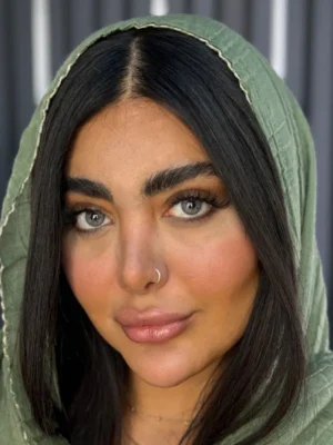 لنز چشم آلموند گری آماندا روی چشم سیاه