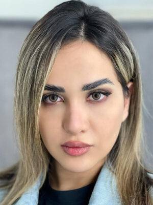 لنز آیس کالر سالانه سبز عسلی دور دار از سری لاکچری Ice Color charming green
