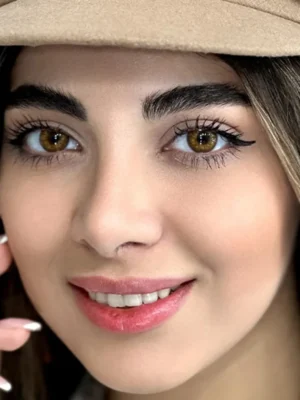لنز رنگی عسلی گرم بافت کهکشانی رز یونیک روی چشم قهوه ای