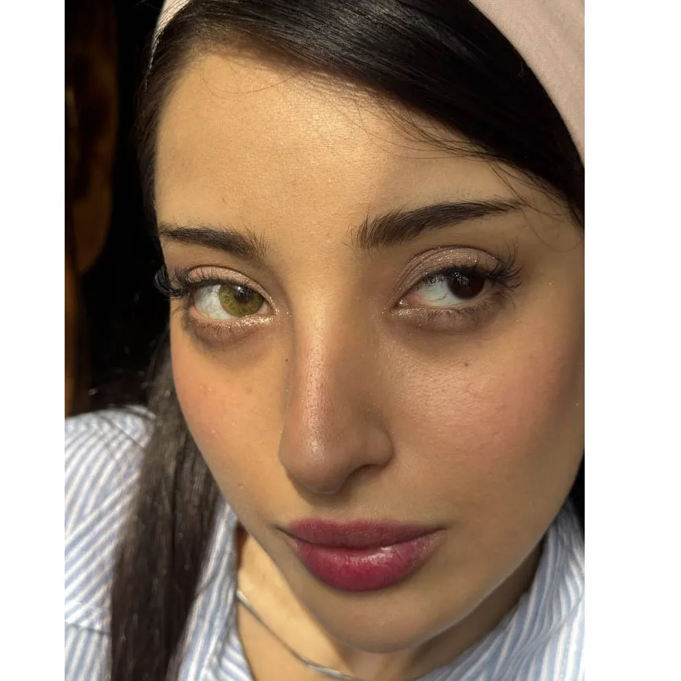 لنز رینگ گرین سلنا