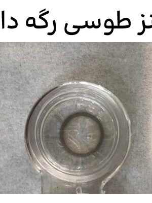 لنز چشم طوسی رگه دار