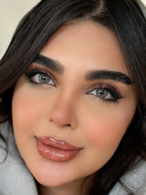 لنز چشم طوسی رگه دار