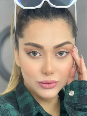 لنز آیس کالر چارمینگ گرین(لاکچری) - Image 2