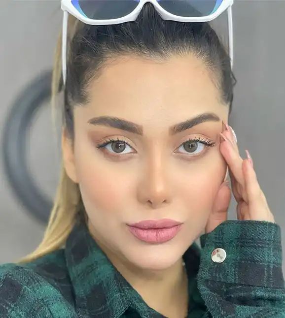 لنز آیس کالر چارمینگ گرین(لاکچری) - Image 2