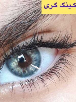 لنز رنگی آماندا کینگ گری